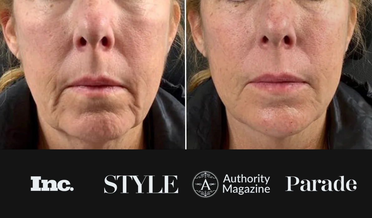 Before and after results - As featured in Inc., STYLE, Authority Magazine, Parade