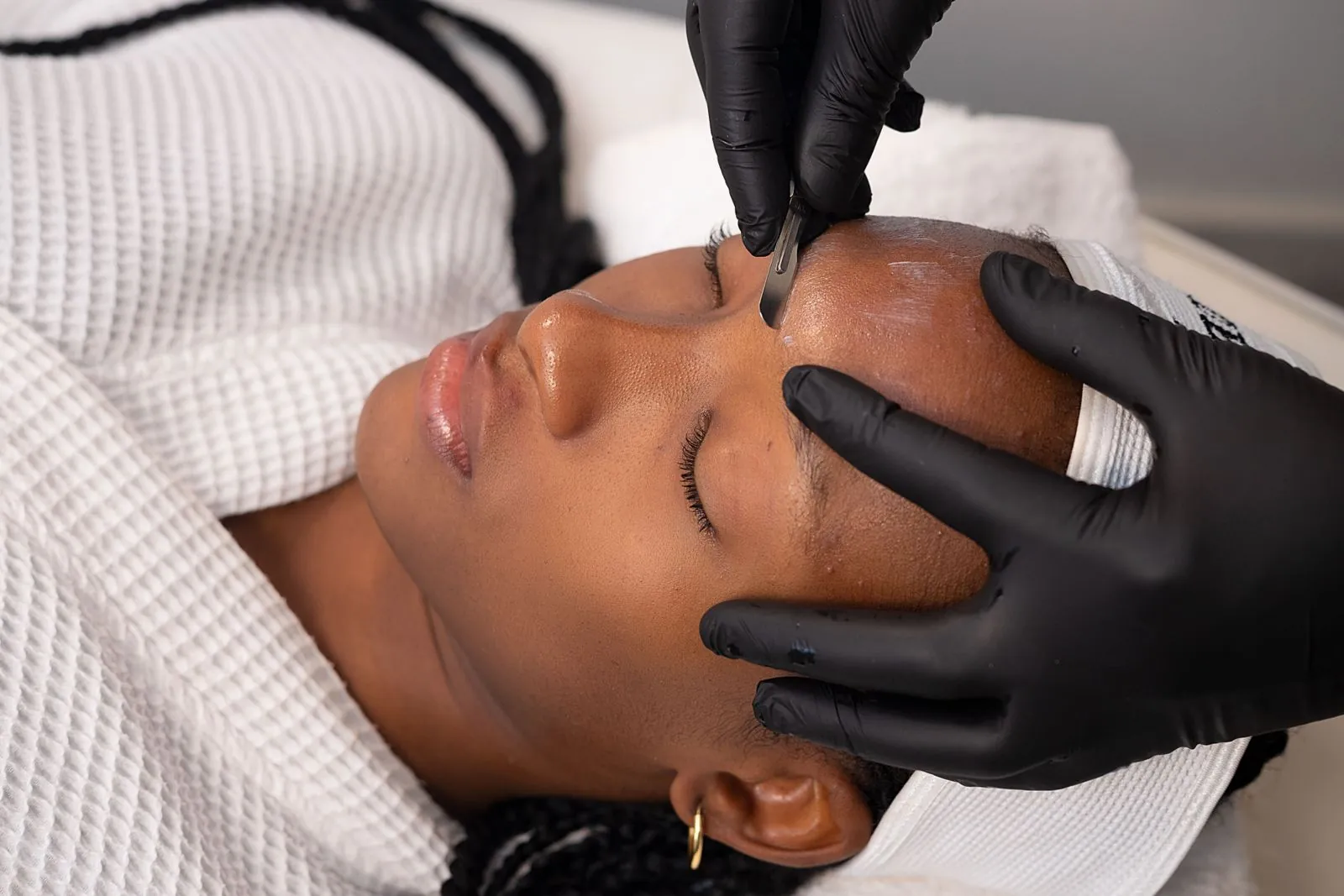 A gloved professional glides a dermaplaning blade across a client's forehead while holding the skin taut