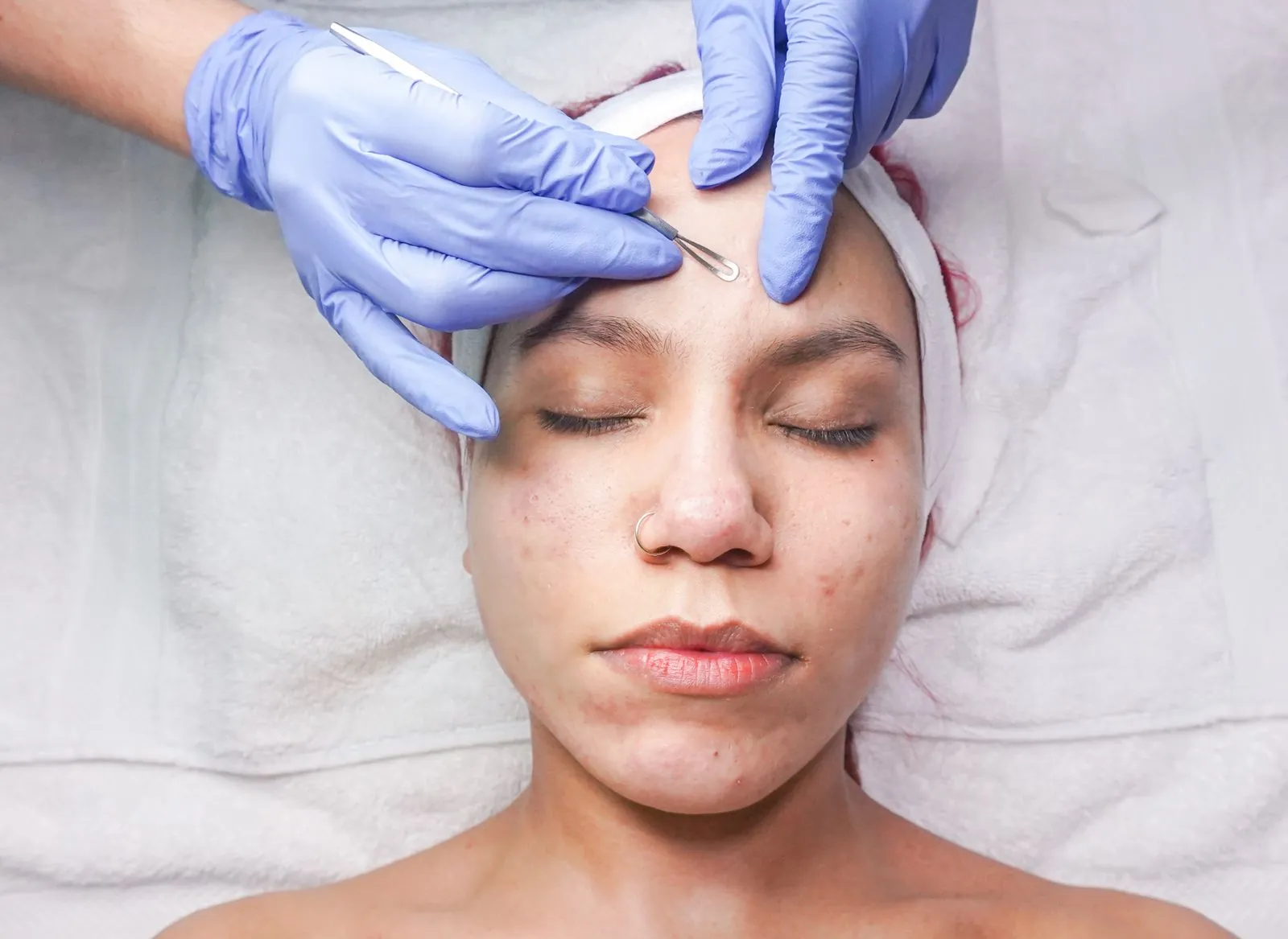 Gloved hands hold a woman's forehead skin taut while working a small handheld tool along the brow line