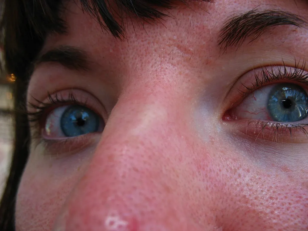 Macro photo of the skin on the bridge of a nose and the cheeks, showing rows of visible pores