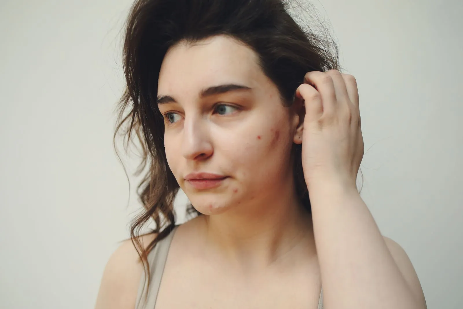 Young adult woman with a few mild acne spots on her cheek and jaw