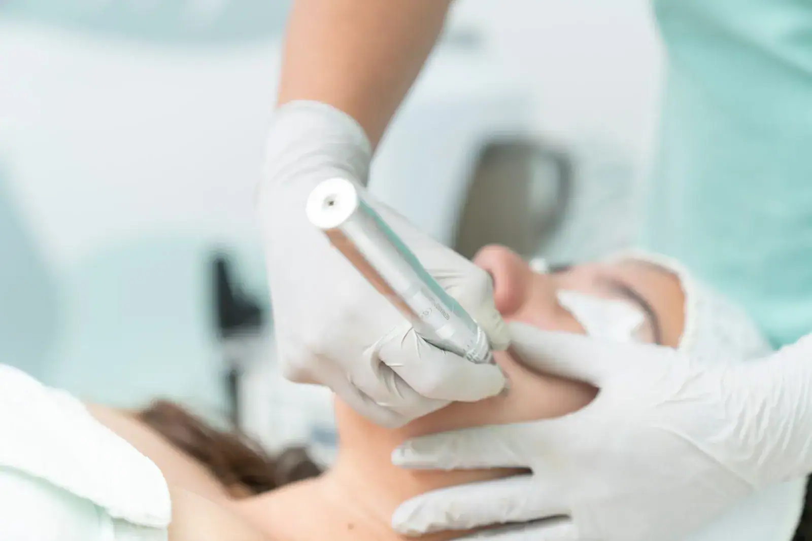 A gloved practitioner guiding a handheld treatment pen across a patient's cheek