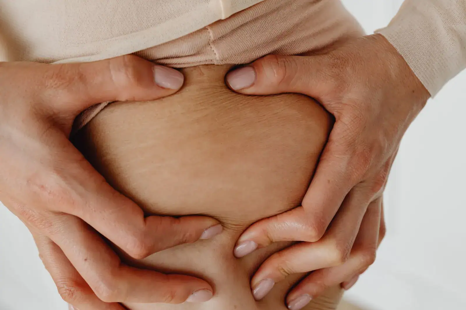 Close-up of hands pressing skin that has stretch marks