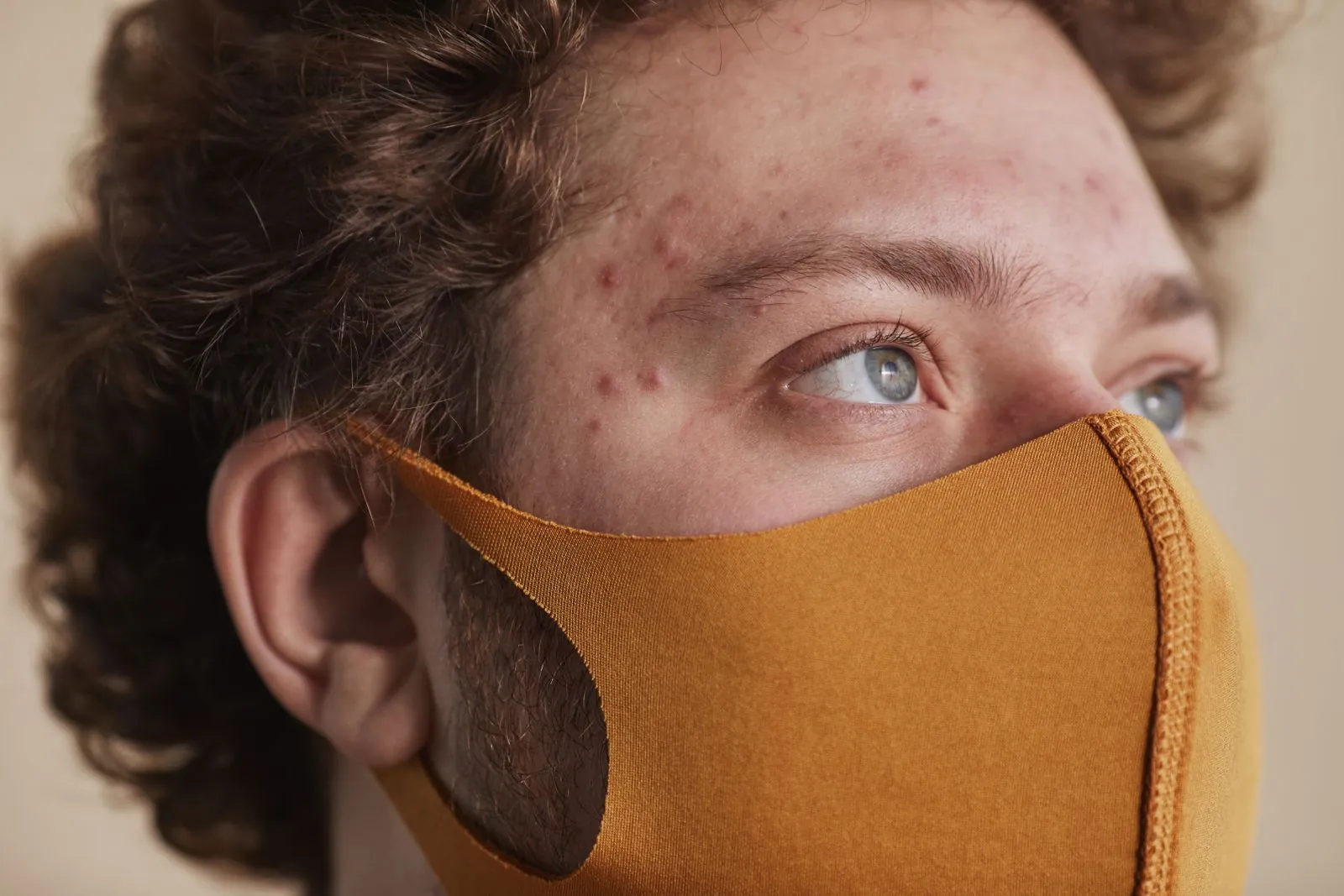 Man wearing a fabric face mask with small breakouts on his forehead and upper cheek