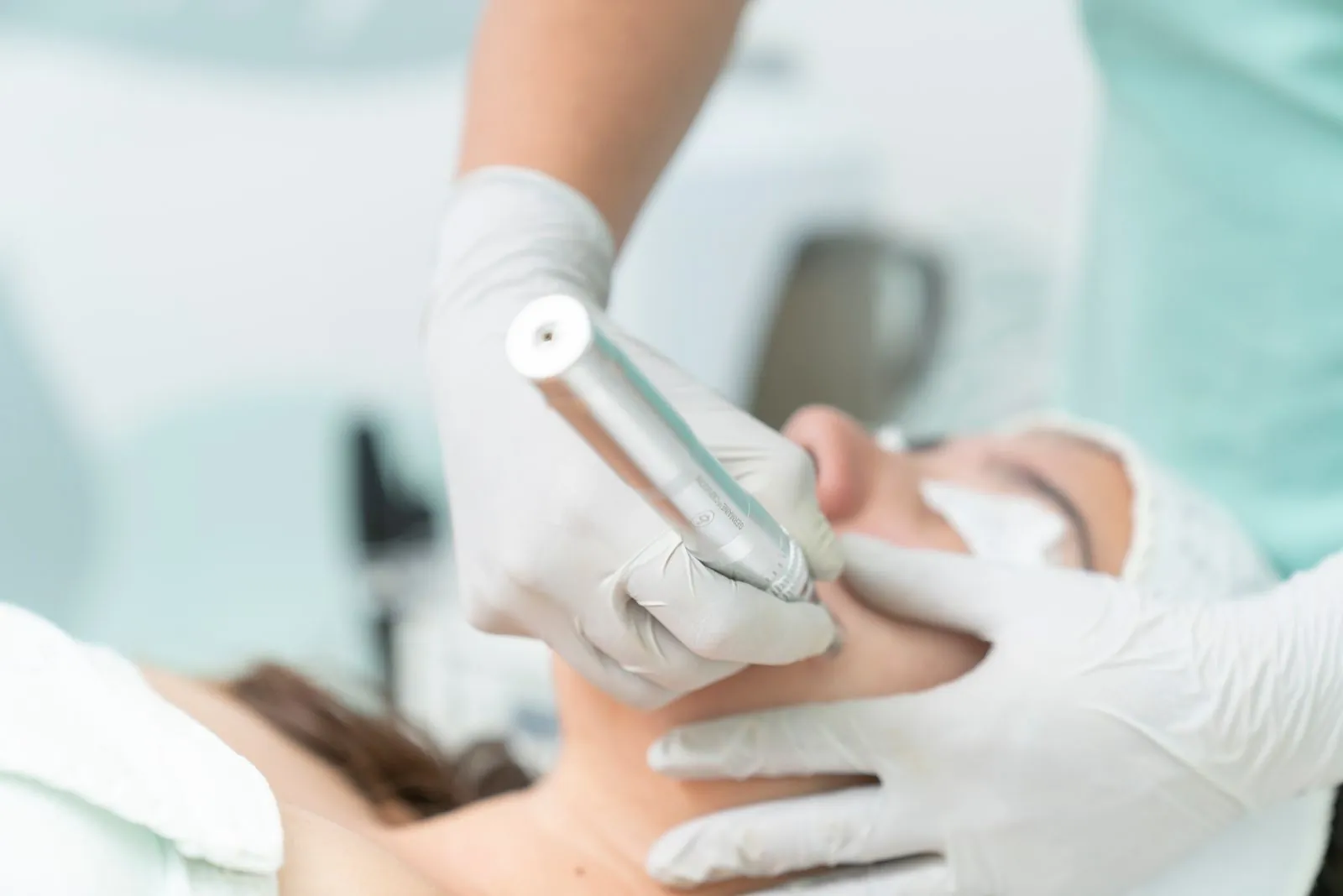 Gloved hands guiding a microneedling pen across a client's cheek in a clinic
