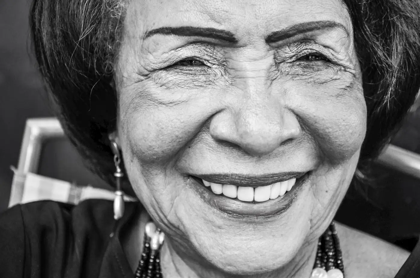 Smiling older woman with visible smile lines running from the sides of her nose to the corners of her mouth